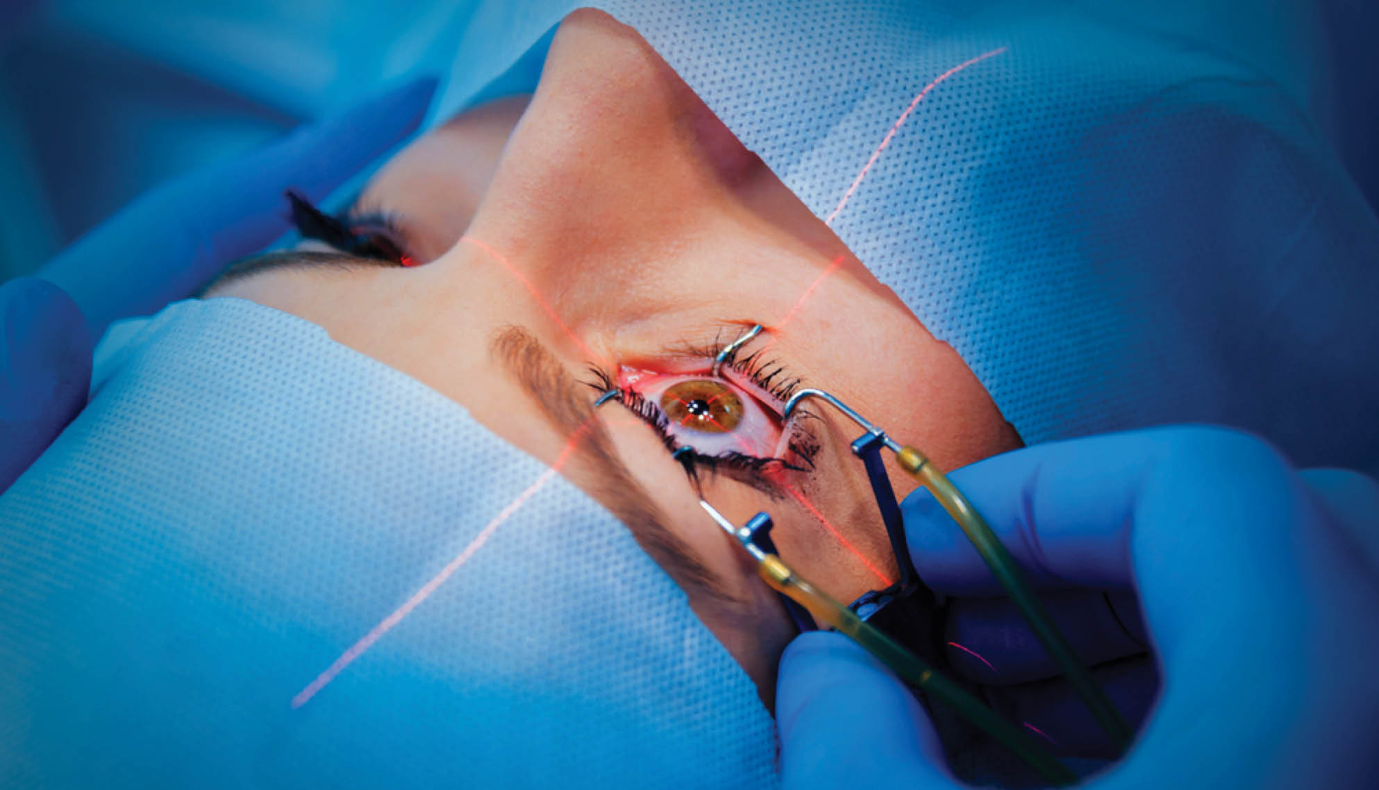 https://soliseyecare.com/wp-content/uploads/2025/07/LASIK-Refractive-Surgery_01.jpg