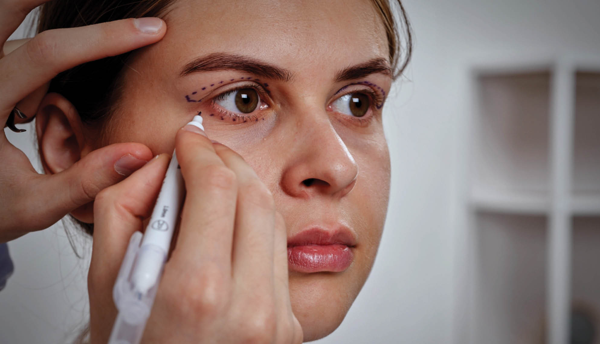 https://soliseyecare.com/wp-content/uploads/2025/07/Oculoplasty-Aesthetic-Eye-Care_01.jpg