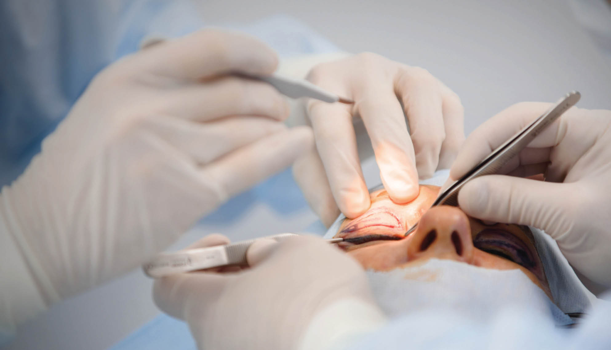 https://soliseyecare.com/wp-content/uploads/2025/07/Oculoplasty-Aesthetic-Eye-Care_04.jpg