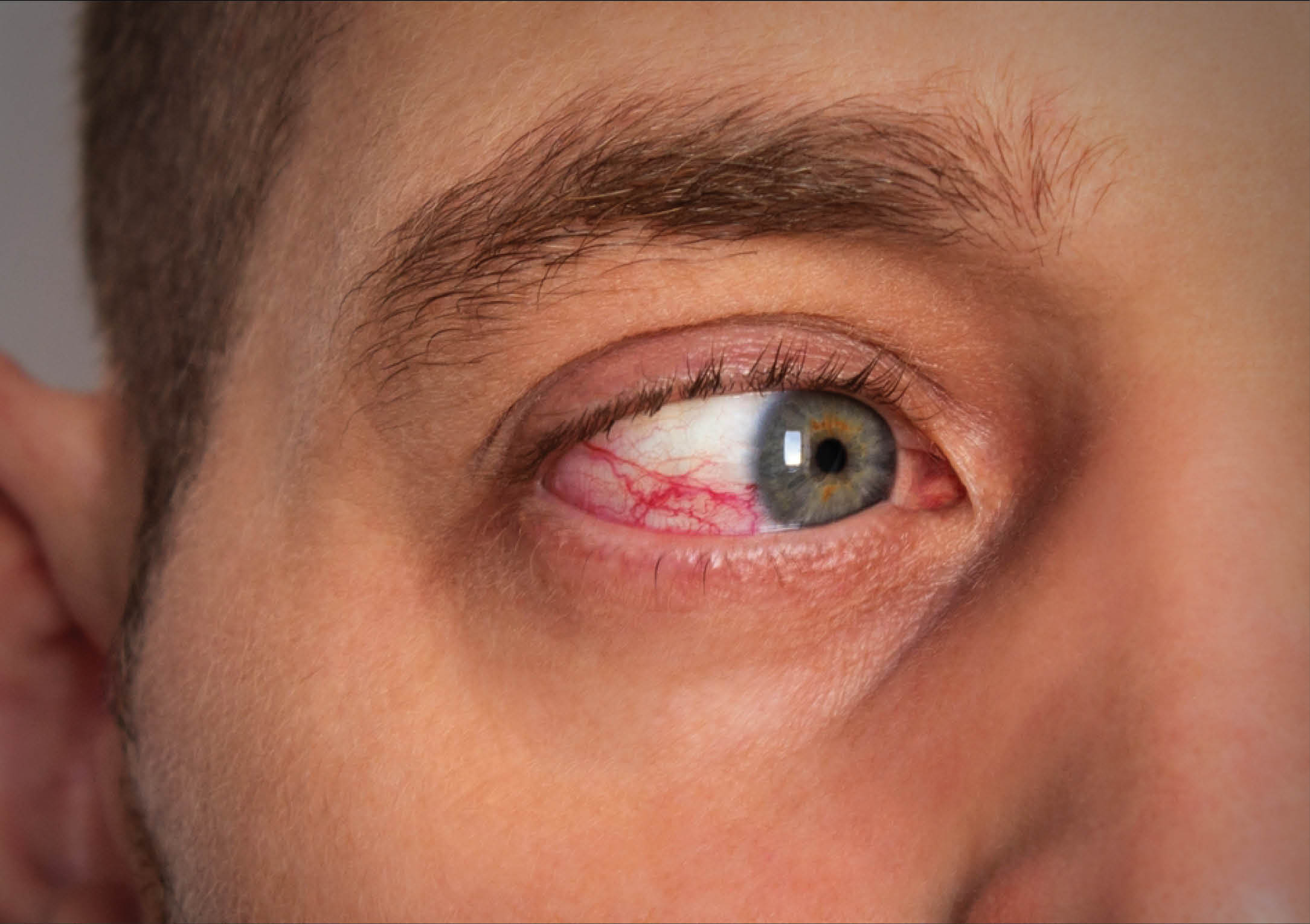 https://soliseyecare.com/wp-content/uploads/2025/07/UVEA_03.jpg