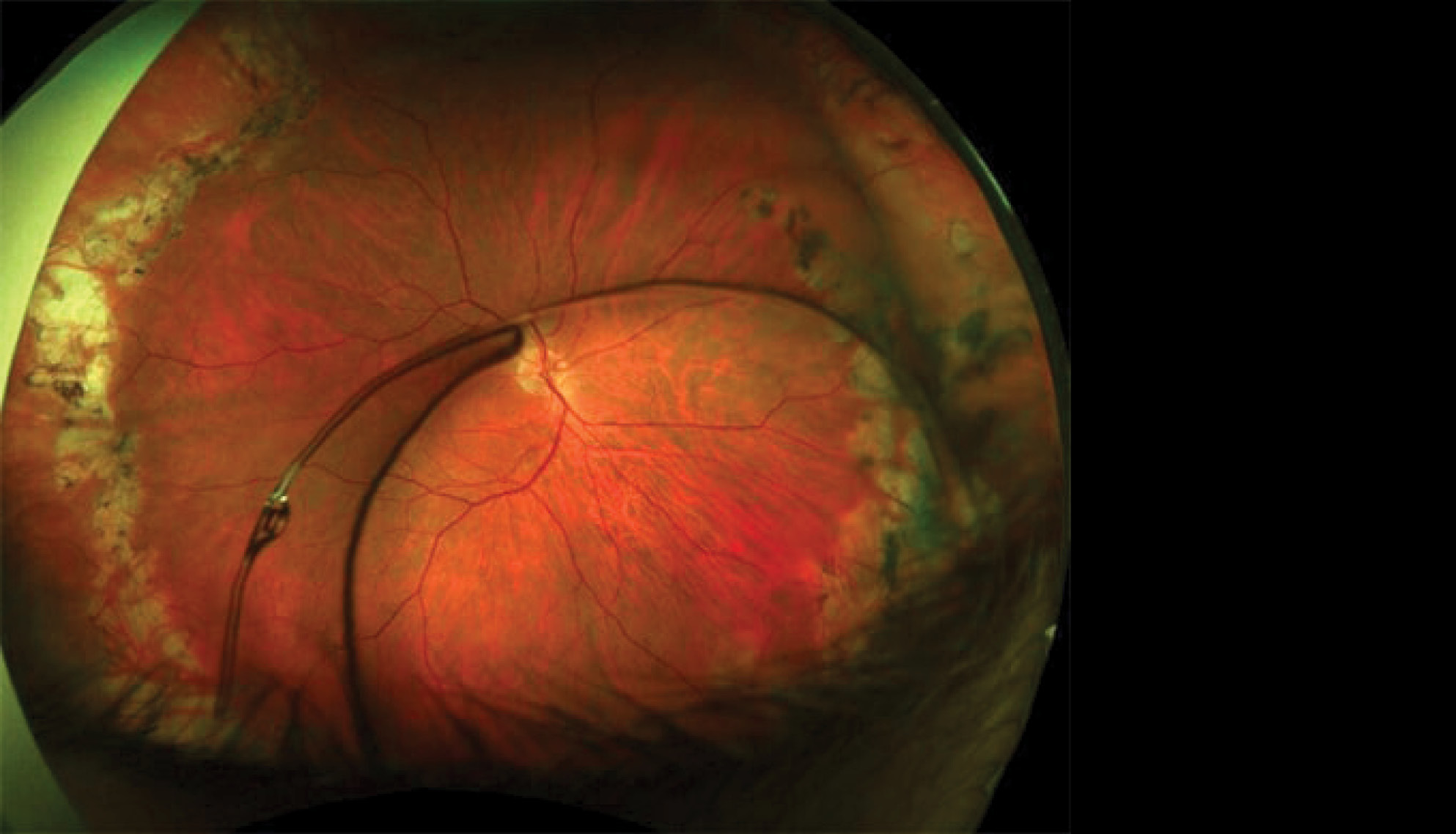 https://soliseyecare.com/wp-content/uploads/2025/09/anterior-segment-dsorders-1.jpg