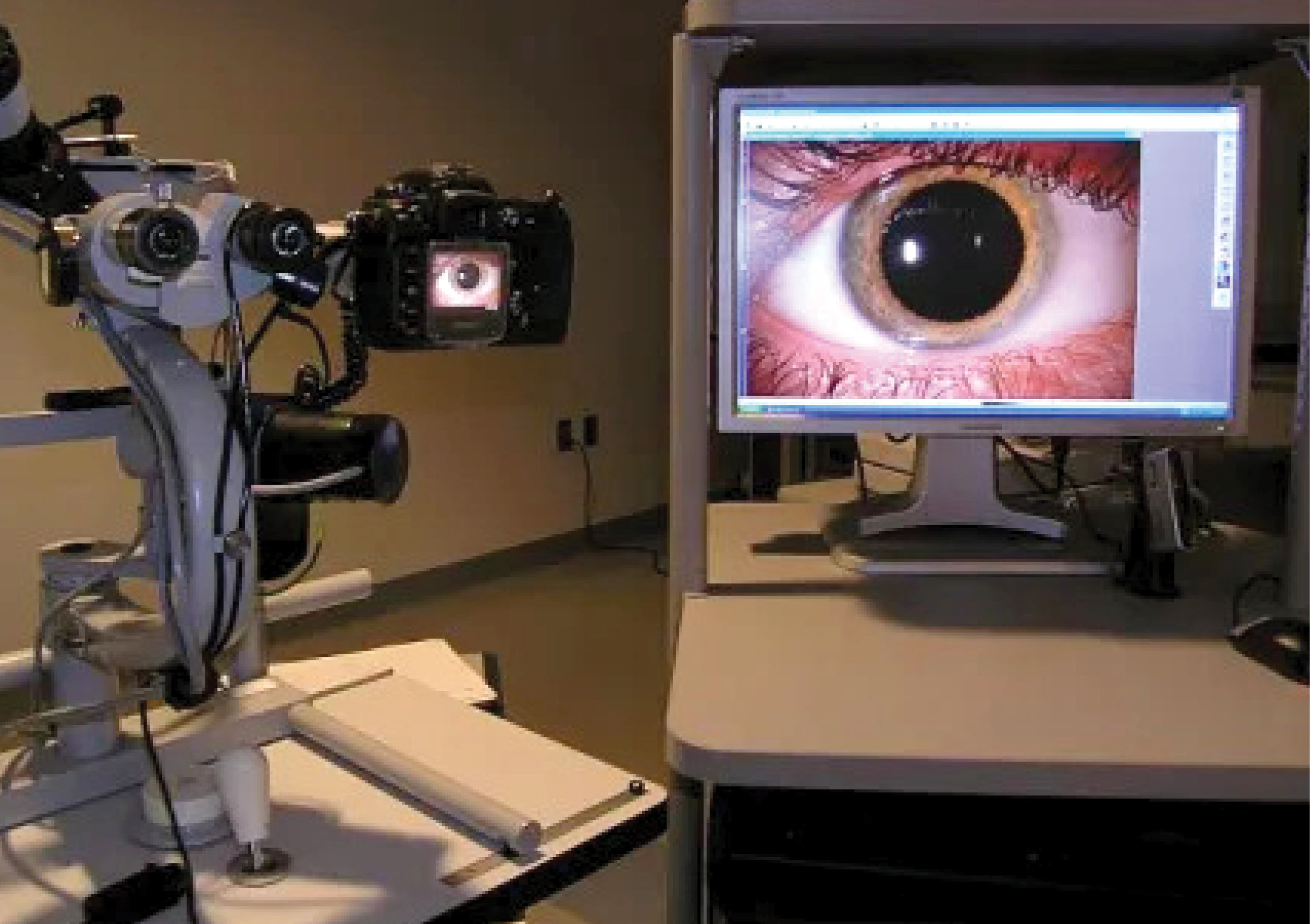 https://soliseyecare.com/wp-content/uploads/2025/09/anterior-segment-dsorders-2.jpg