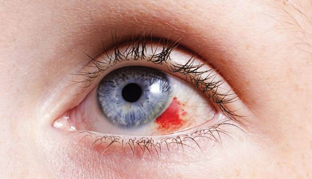 https://soliseyecare.com/wp-content/uploads/2025/09/trauma-1.jpg