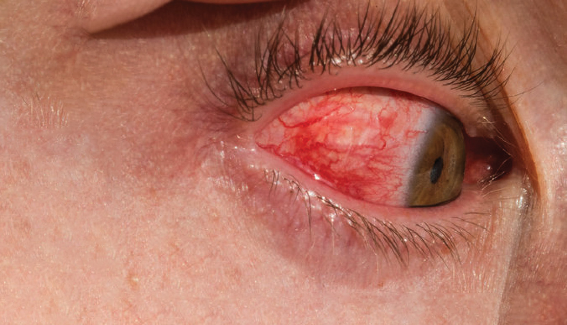 https://soliseyecare.com/wp-content/uploads/2025/09/uvea_01.jpg